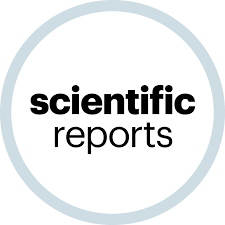 Multi-objective optimization of regenerative ORC system